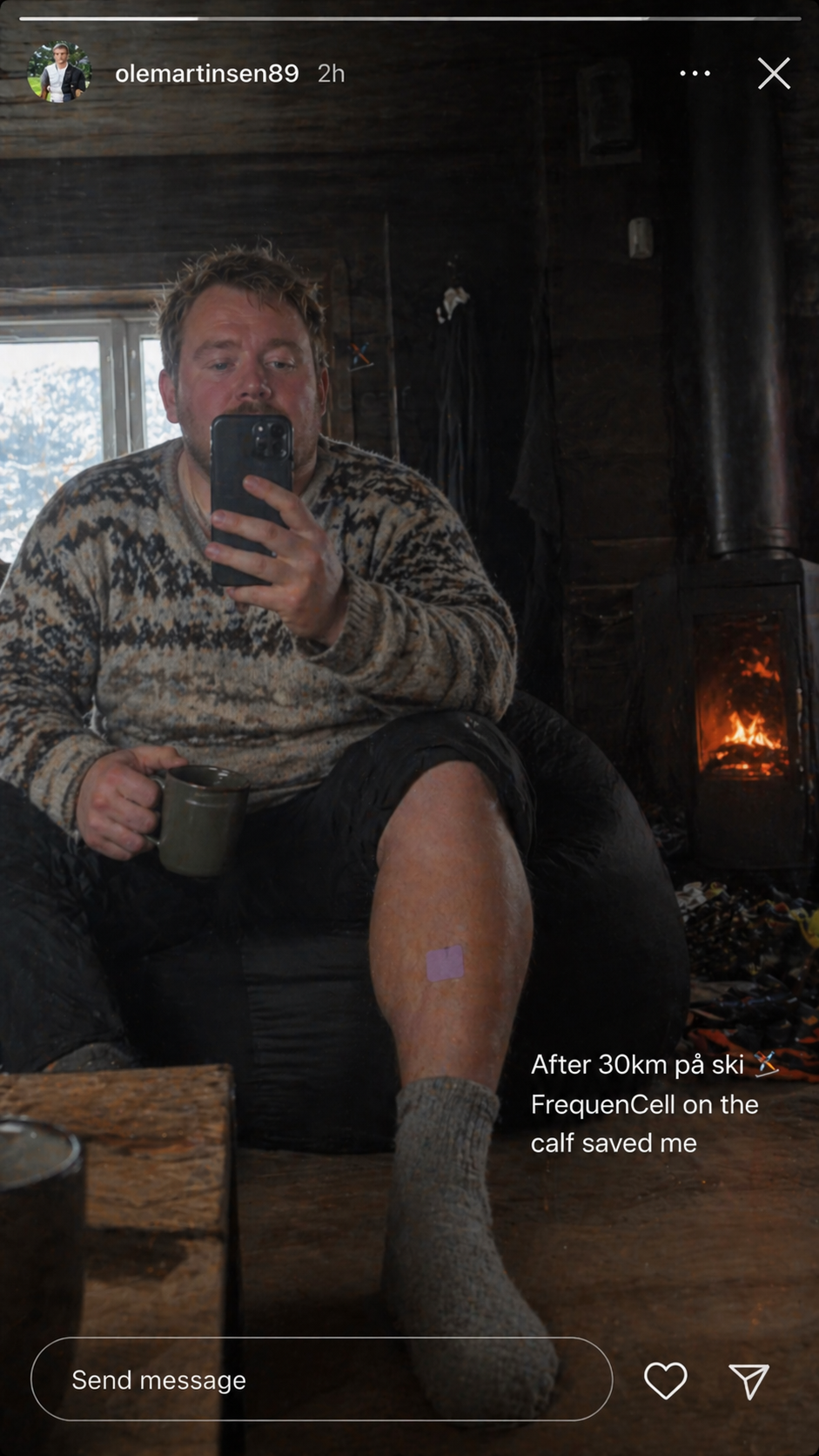 After 30km på ski. FrequenCell on the calf saved me
